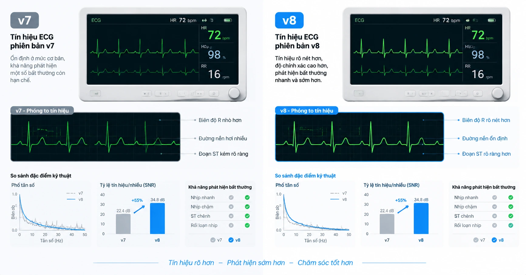 Tìm hiểu về v7 v8 ecg: Công nghệ và ứng dụng nổi bật - image 3